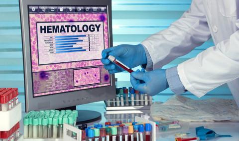 know about Hematology Test