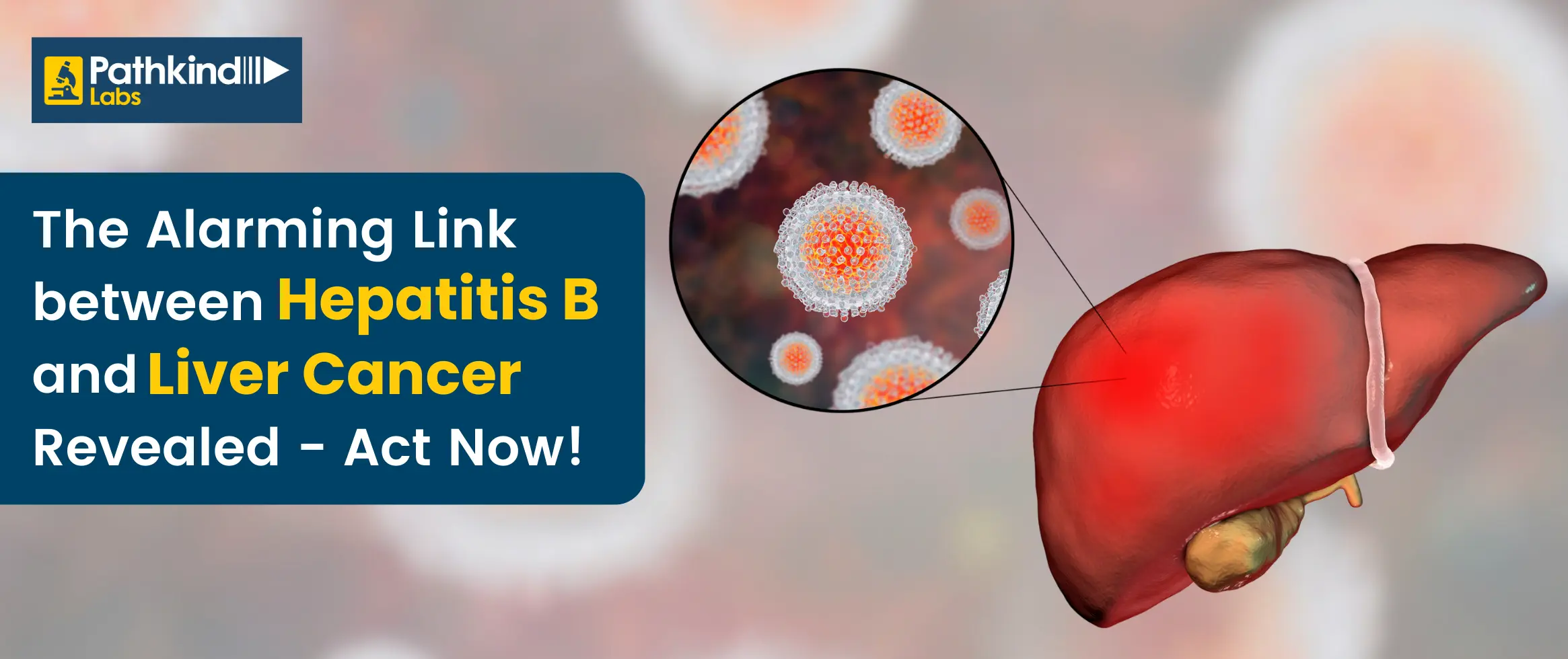 Alarming Link between Hepatitis B and Liver Cancer