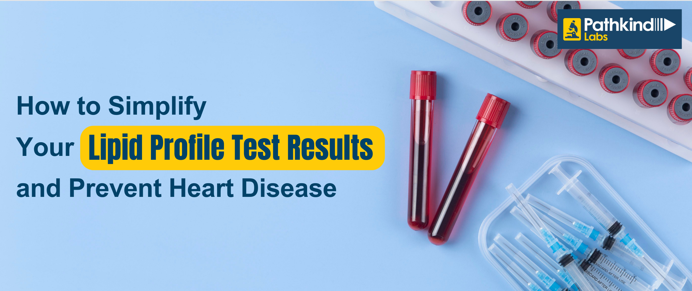 Lipid Profile Test Results