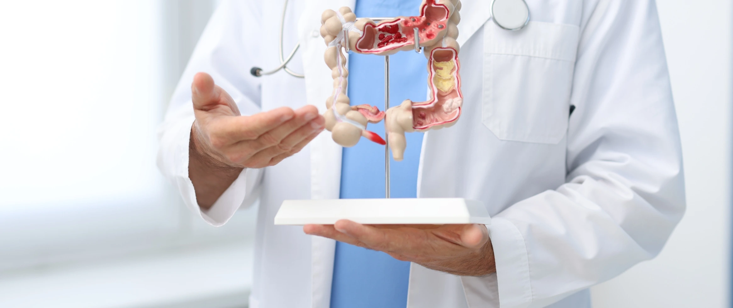 rectal cancer symptoms