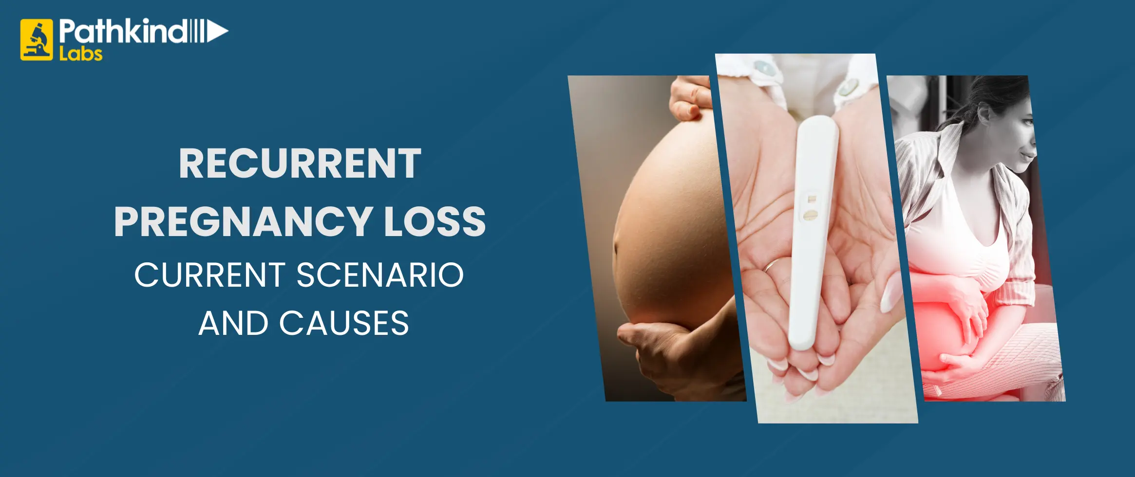 Recurrent Pregnancy Loss