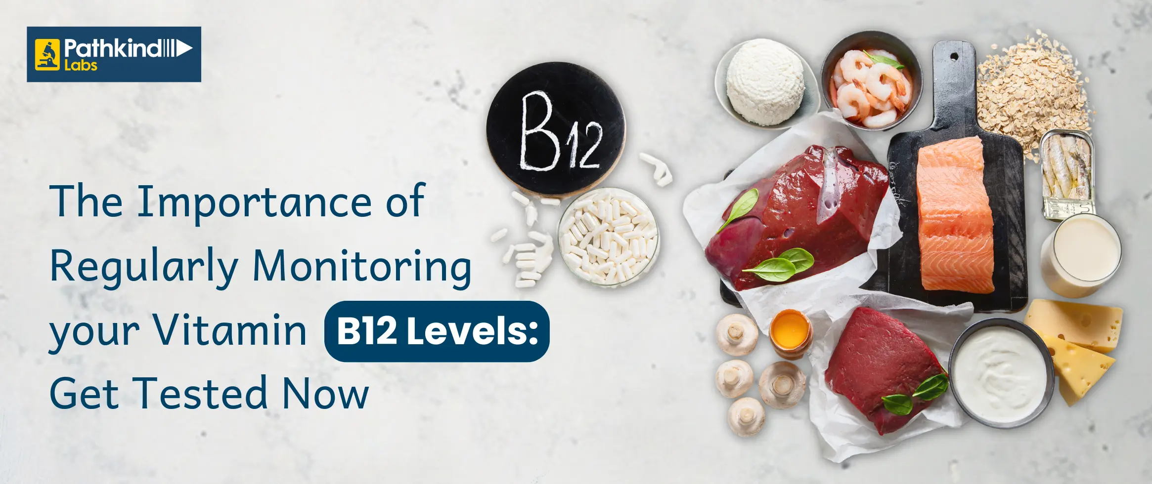 Vitamin B12 Test