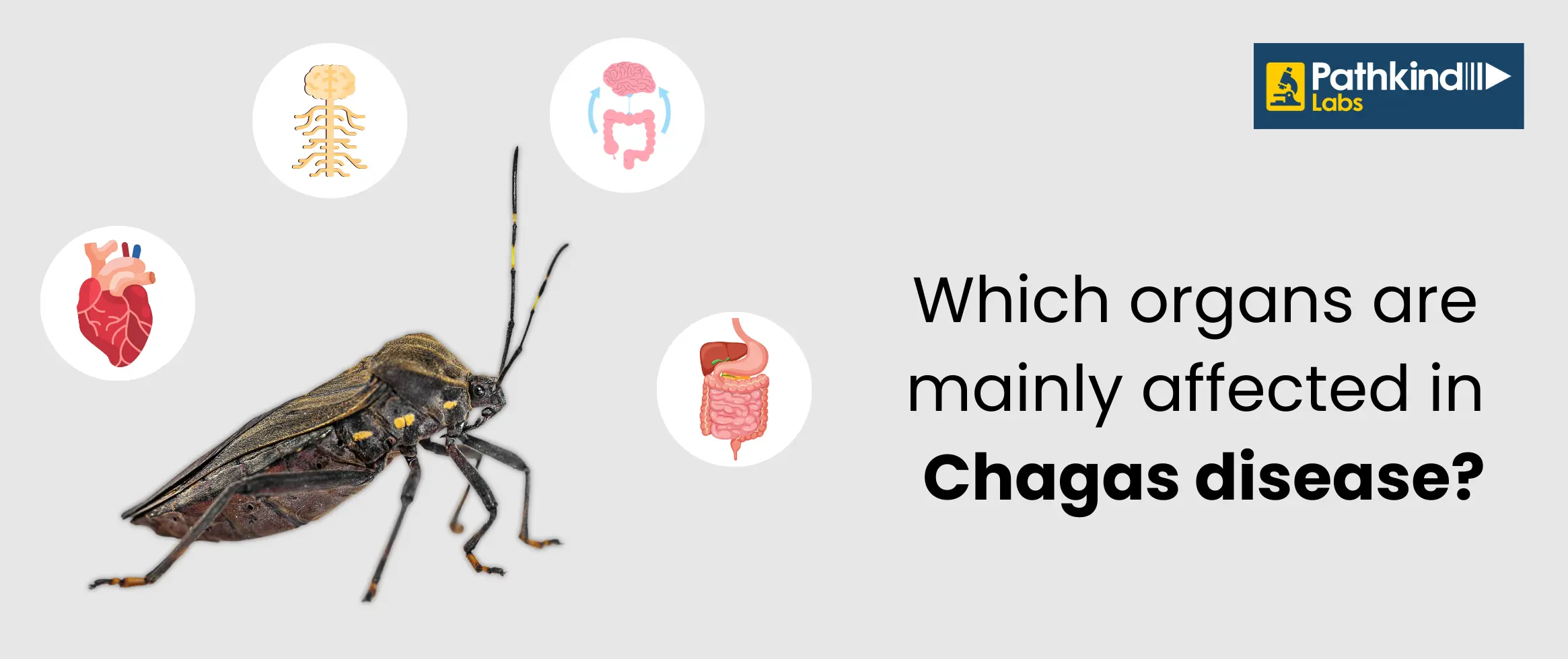 Chagas Disease