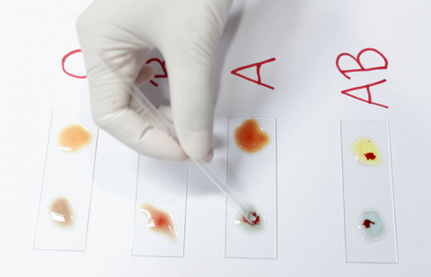 Blood Type and Rh factor