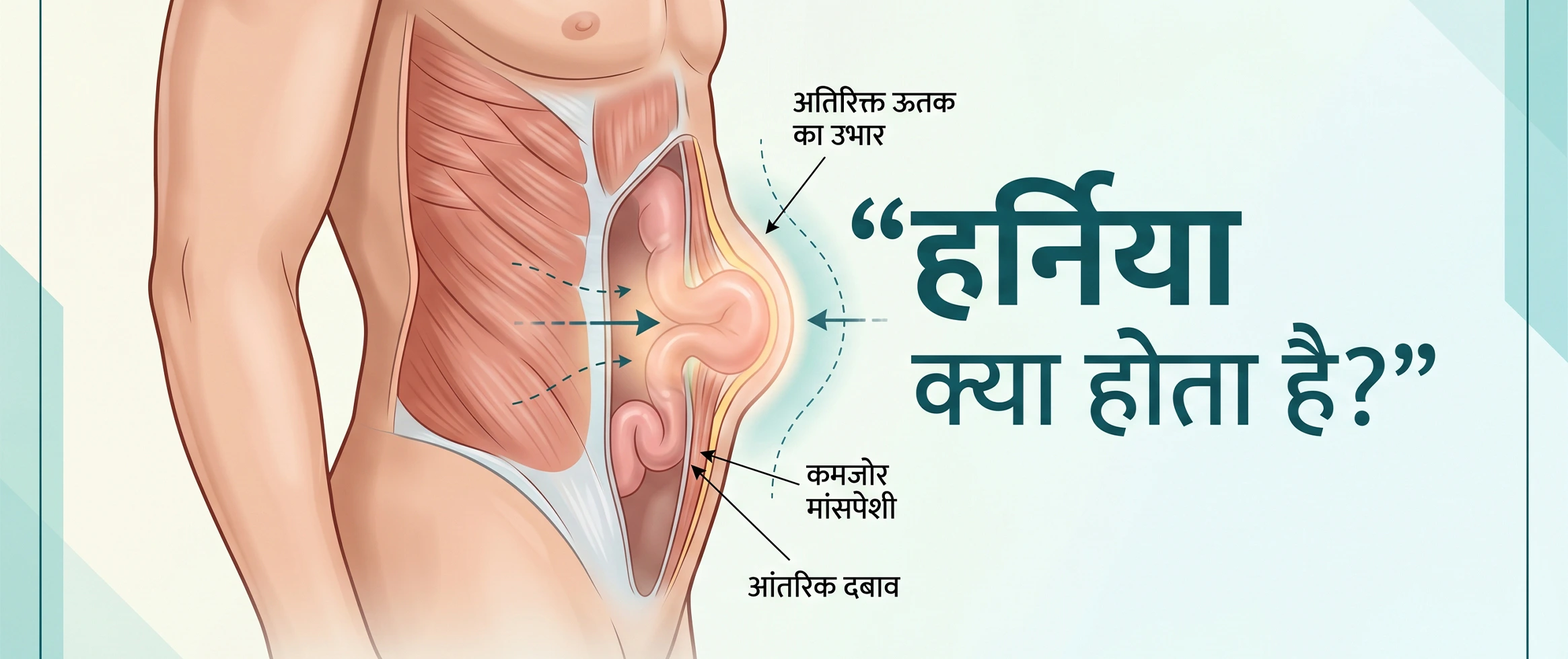 Hernia kya hota hai
